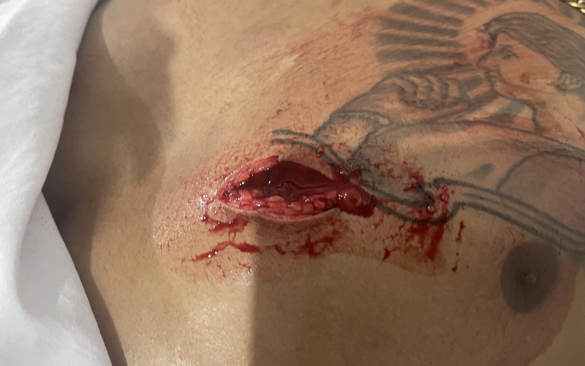 Três pessoas são esfaqueadas durante briga em baile em Porto Murtinho.