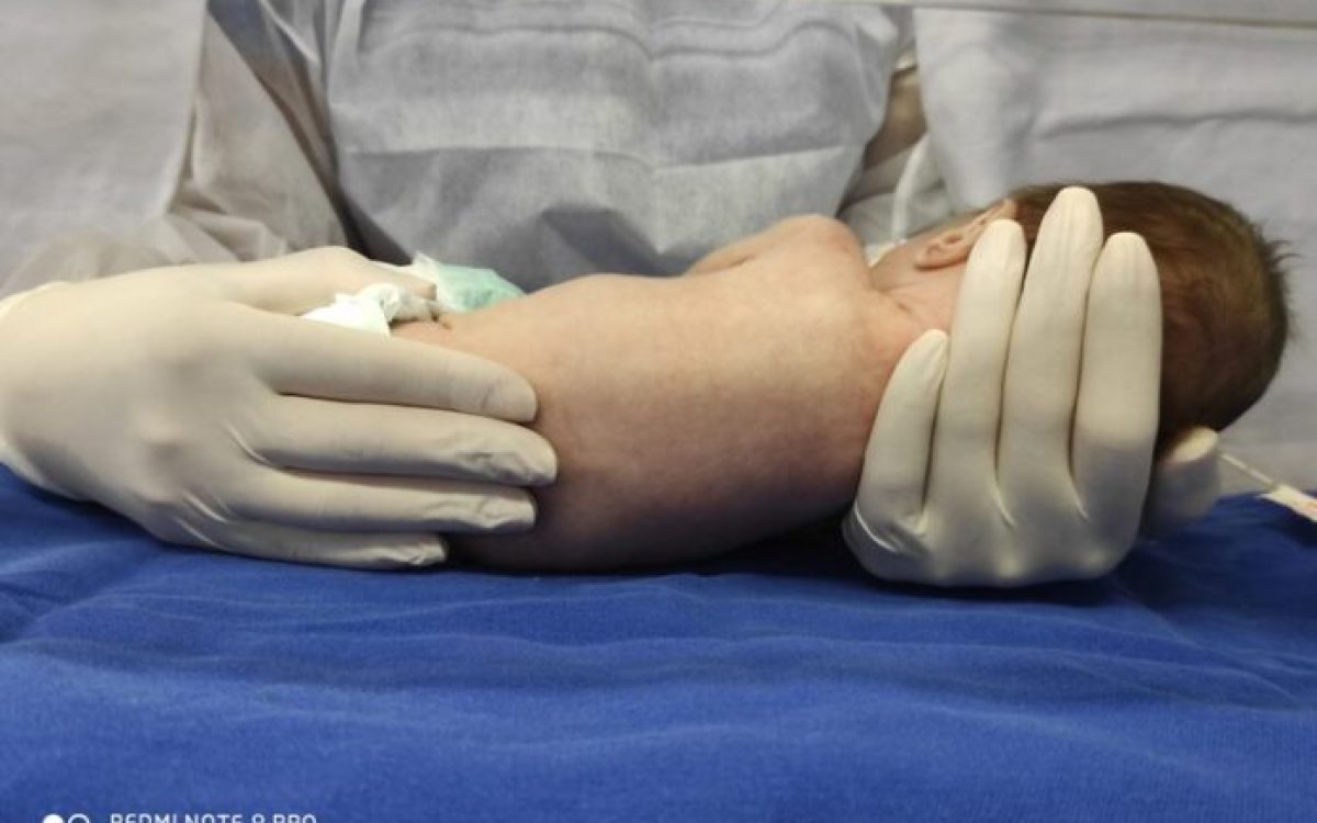 Estudo evidencia benefícios da fisioterapia neonatal em bebês prematuros clinicamente estáveis